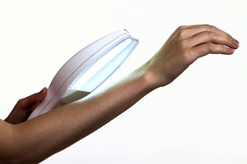 How to treat psoriasis